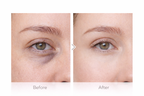 Sakura Eye Sérum Roll Contour des Yeux Éclat et Anti Cernes