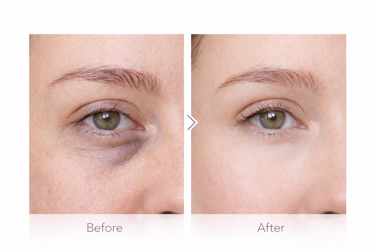 Sakura Eye Sérum Roll Contour des Yeux Éclat et Anti Cernes